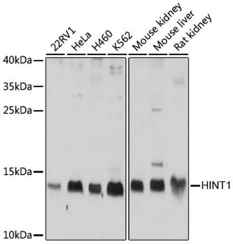 Antibodie to-HINT1 