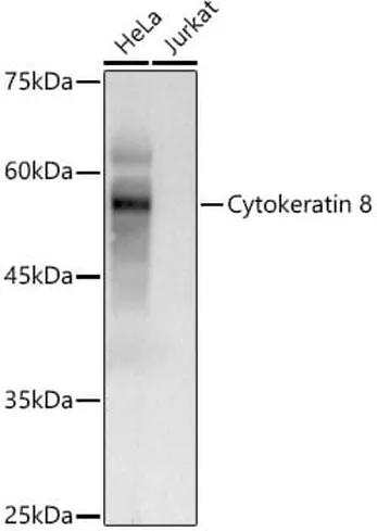 Antibodie to-KRT8  - Identical to Abcam (ab175249)