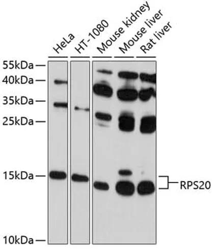 Antibodie to-RPS20 