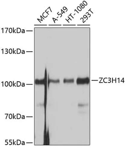 Antibodie to-ZC3H14 