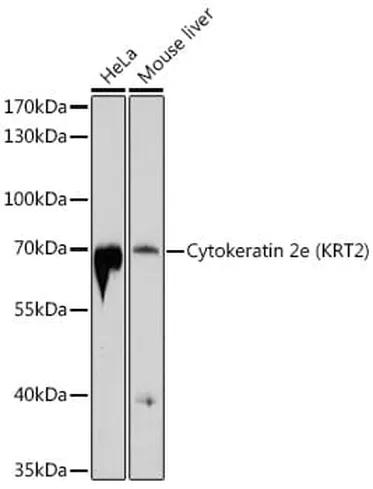 Antibodie to-KRT2 