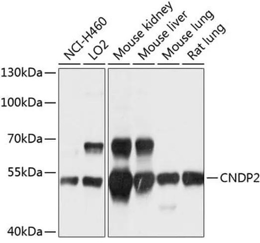 Antibodie to-CNDP2 