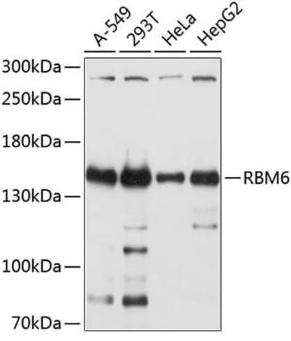 Antibodie to-RBM6 