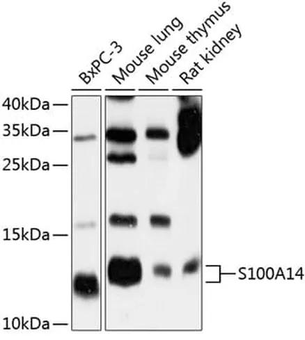 Antibodie to-S100A14 