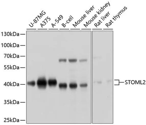 Antibodie to-STOML2 