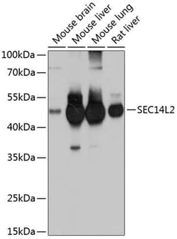 Antibodie to-SEC14L2 