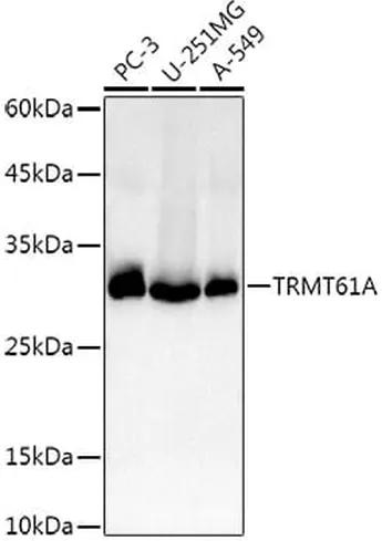Antibodie to-TRMT61A 