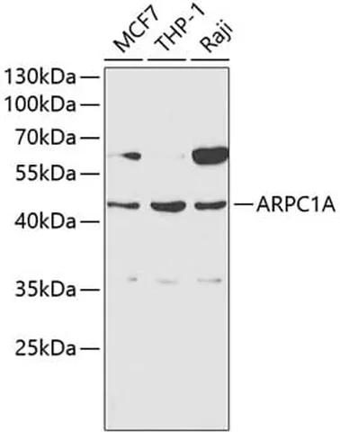 Antibodie to-ARPC1A 