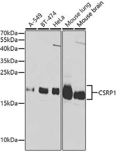 Antibodie to-CSRP1 