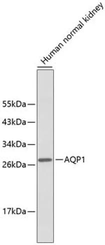 Antibodie to-AQP1 