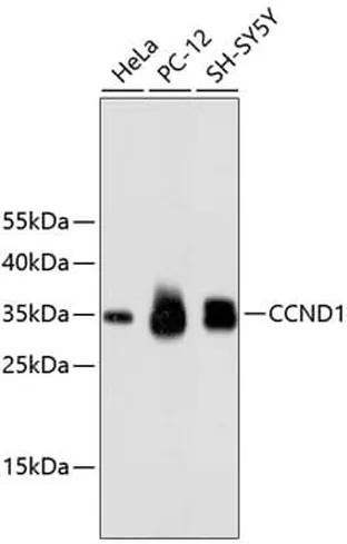 Antibodie to-CCND1  [Assigned #A10757]
