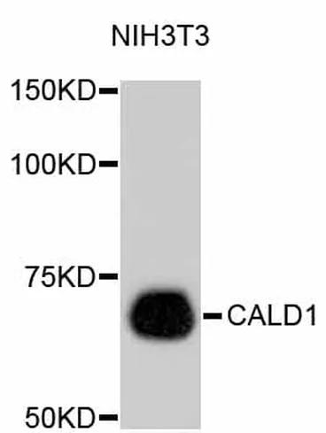 Antibodie to-CALD1  [Assigned #A10768]