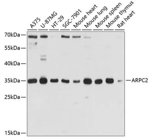 Antibodie to-ARPC2 