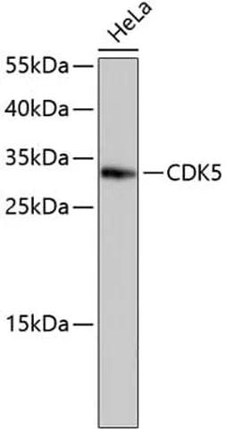 Antibodie to-CDK5  [Assigned #A10814]