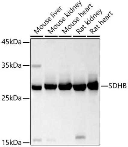 Antibodie to-SDHB 