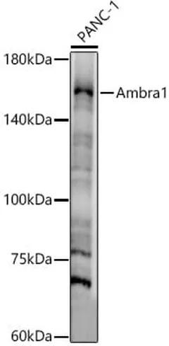Antibodie to-FLJ20294 