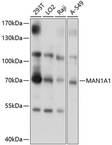 Antibodie to-MAN1A1 