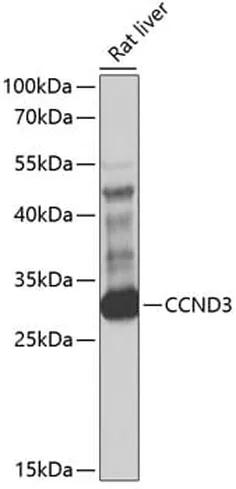 Antibodie to-CCND3 