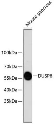 Antibodie to-DUSP6  [Assigned #A10847]