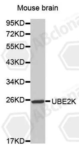 Antibodie to-UBE2K 