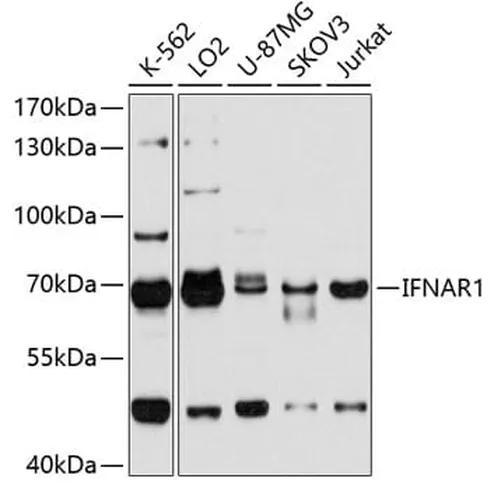 Antibodie to-IFNAR1 