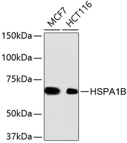 Antibodie to-Hsp70  [Assigned #A10897]
