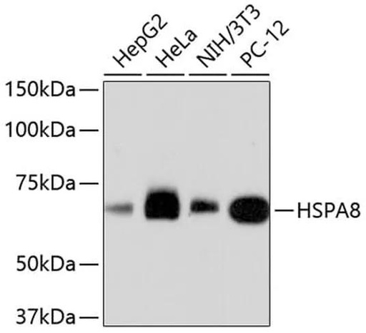 Antibodie to-HSPA8  [Assigned #A10898]