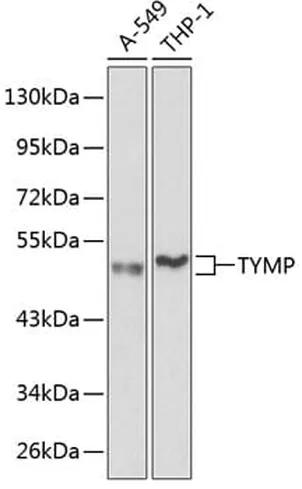 Antibodie to-TYMP  - Identical to Abcam (ab180783)