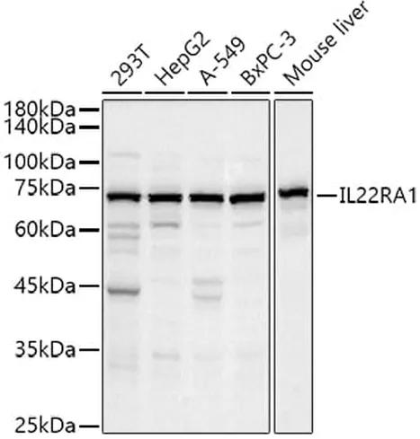 Antibodie to-IL22RA1 