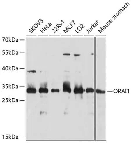 Antibodie to-ORAI1 