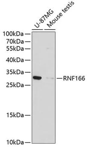Antibodie to-RNF166 