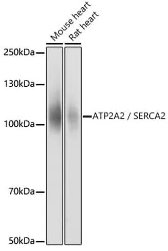 Antibodie to-ATP2A2 