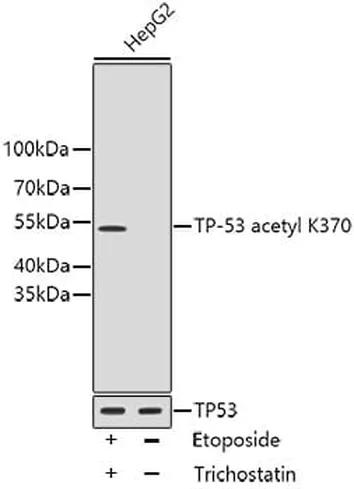 Antibodie to-Acetyl-TP53-K370 mAb 