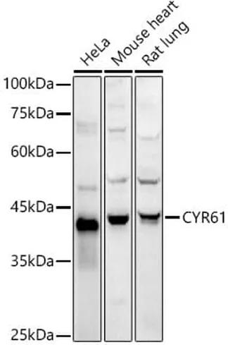 Antibodie to-CYR61 