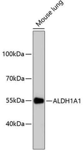Antibodie to-ALDH1A1  [Assigned #A11132]