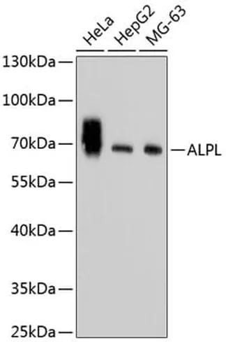 Antibodie to-ALPL  [Assigned #A11138]
