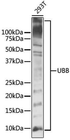Antibodie to-UBB  [Assigned #A11227]