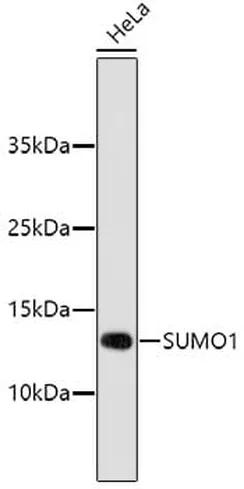 Antibodie to-SUMO1  [Assigned #A11230]