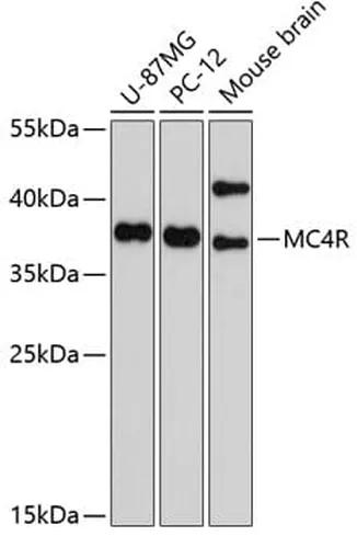 Antibodie to-MC4R 