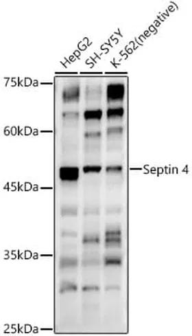 Antibodie to-SEPT4 