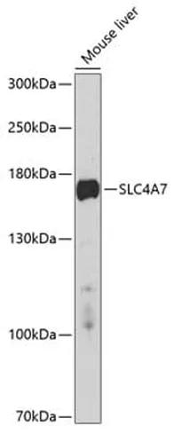 Antibodie to-SLC4A7 