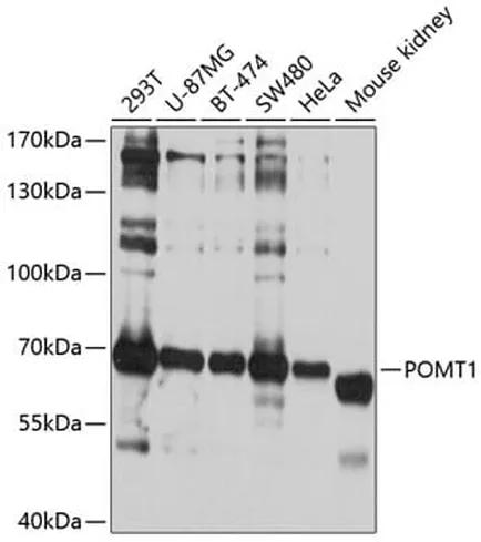 Antibodie to-POMT1 