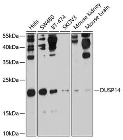 Antibodie to-DUSP14 