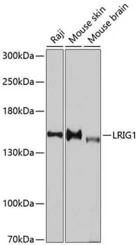 Antibodie to-LRIG1 