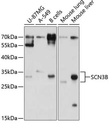 Antibodie to-SCN3B 