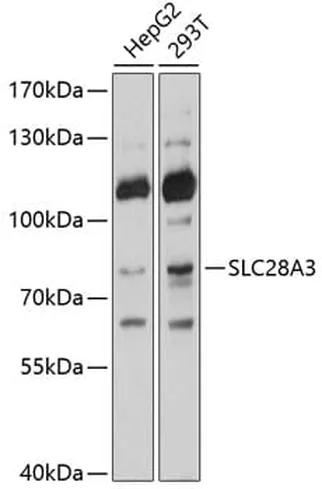 Antibodie to-SLC28A3 