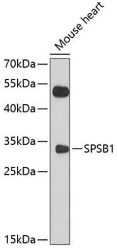 Antibodie to-SPSB1 