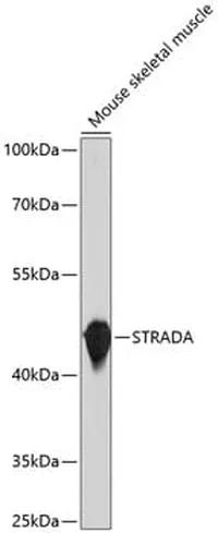 Antibodie to-STRADA 