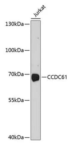 Antibodie to-CCDC61 