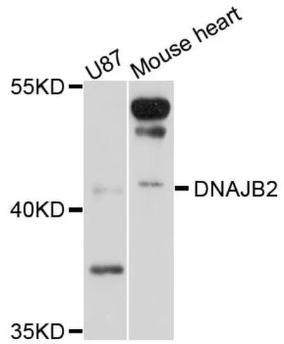 Antibodie to-DNAJB2 
